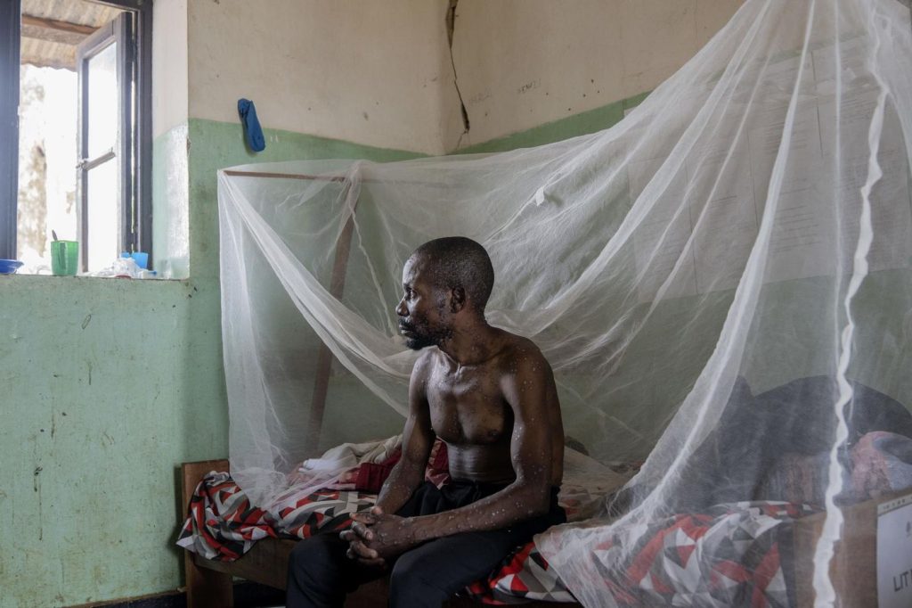 A Kinshasa, la progression du Mpox hors de contrôle