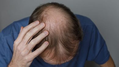 Ce traitement contre la perte de cheveux chez les hommes fonctionne mieux que les autres