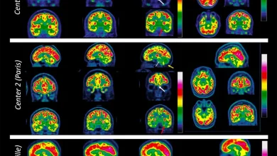 Ce que l’on sait de l’impact du Covid sur votre cerveau