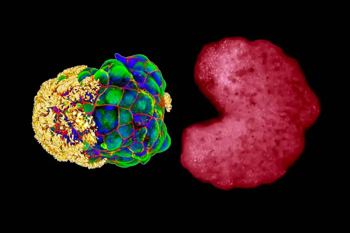 Les scientifiques confirment un « troisième état » entre la vie et la mort