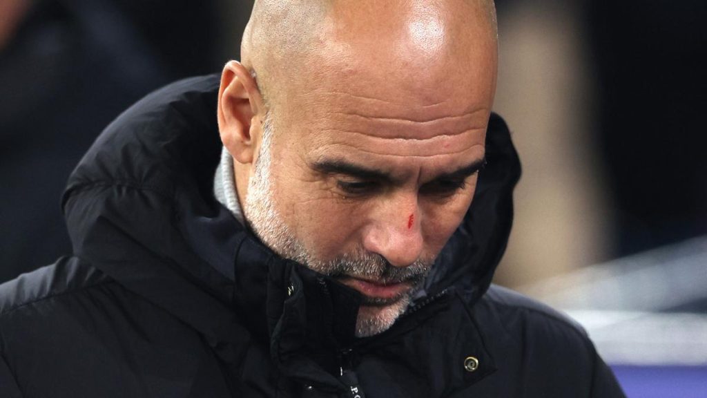 Pep Guardiola explique ses blessures au visage