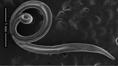 Quand des parasites apparaissent sous la paupière : un cas médical rare